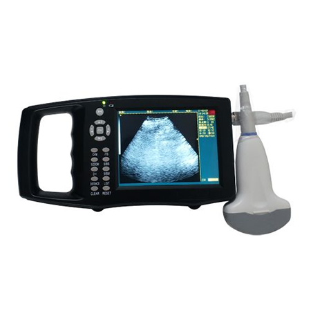 B-mode ultrasonography